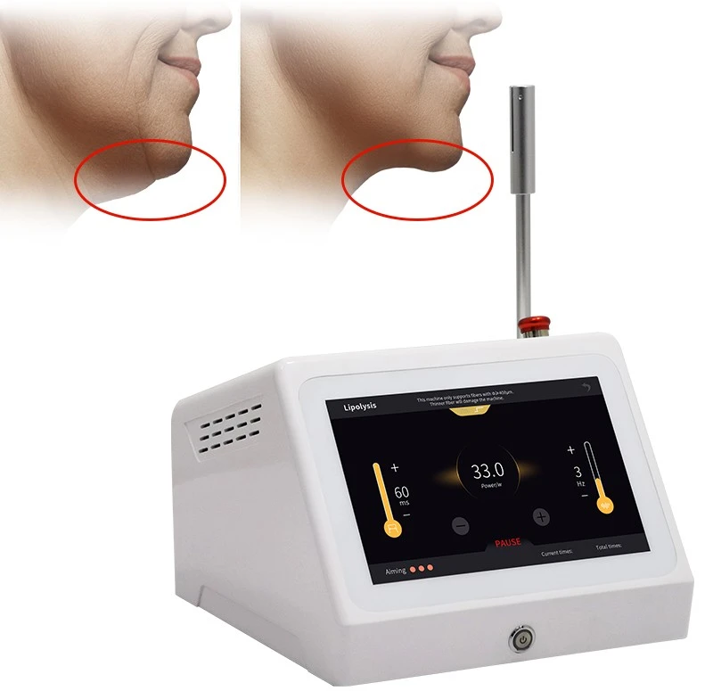 980nm 1470nm 635nm Endolift Laser high quality