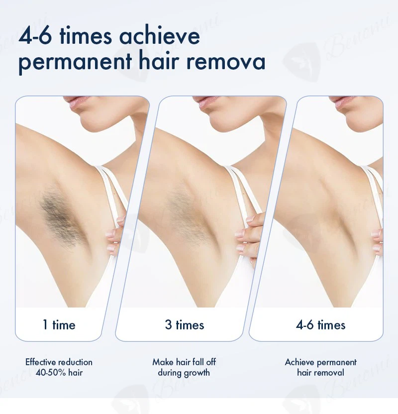 ND-YAGDiode-laser-D1-09